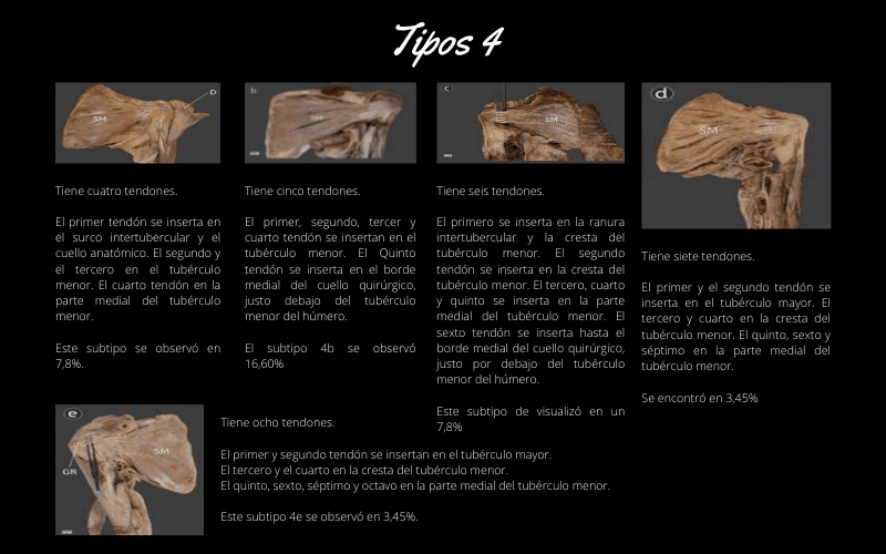 Tendon Subescapular Neuromodulacion.png